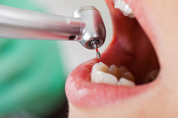 Best Dentist for Tooth Abscess  in Middlebranch, OH